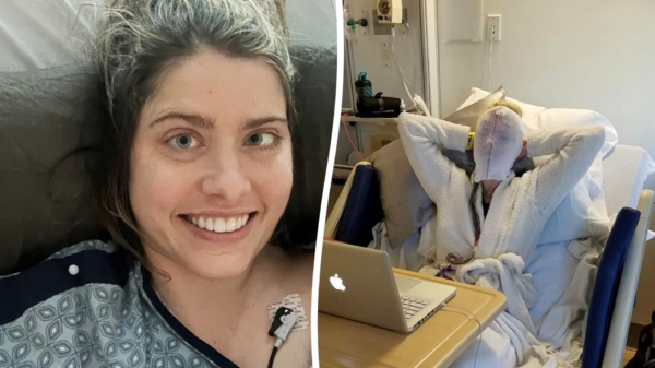Volleyball accident reveals woman’s rare condition leaving her with multiplying tumors